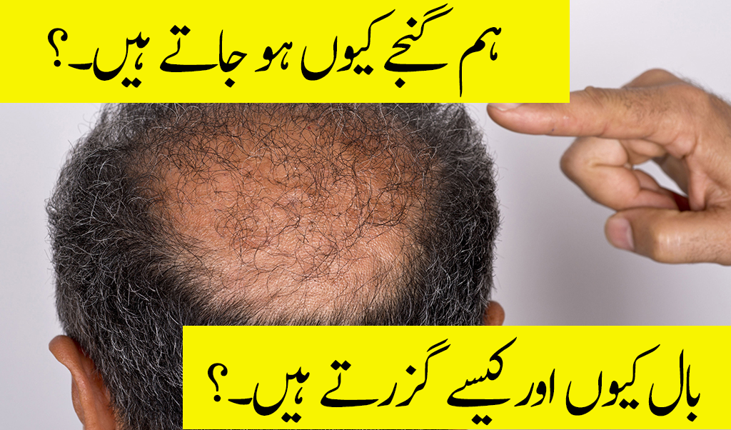 Why do we go Bald And Reason Behind Hair loss. – PAPAR NEWS